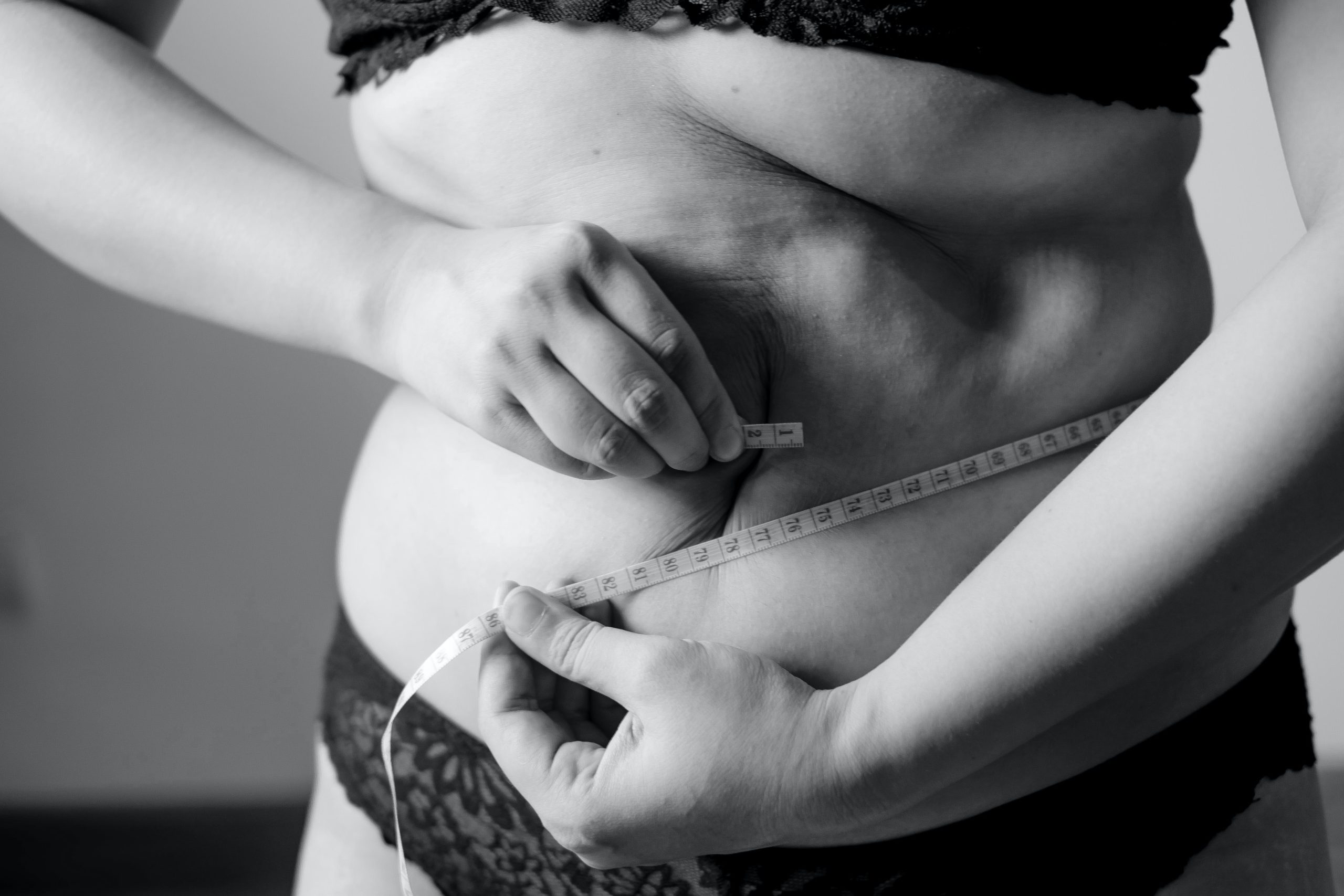 emagrecer sem cirurgia bariátrica