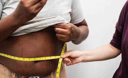obesidade-e-sobrepeso_(1)